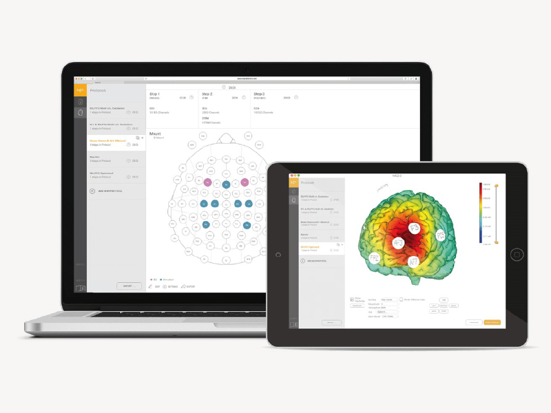The NIC application showing a stimulation montage on a laptop and a 3D brain model on a tablet